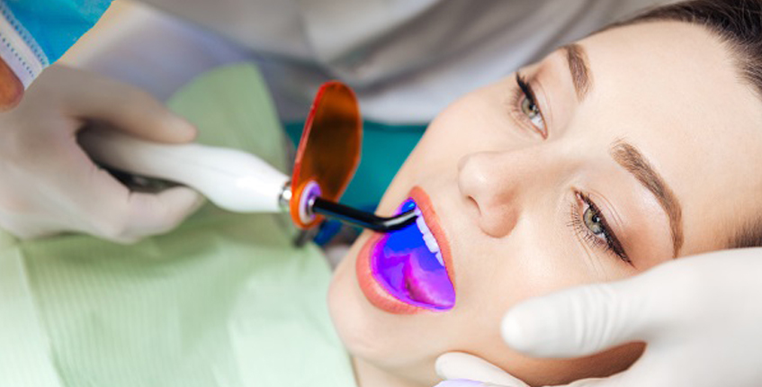 Root Canal Treatment