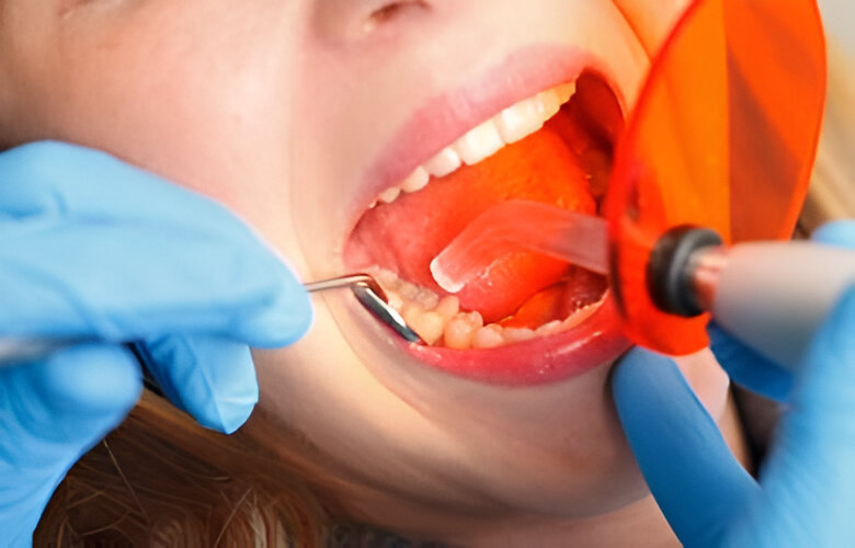 Dental Restoration