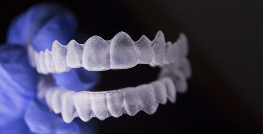 The Hidden Dangers of DIY Braces