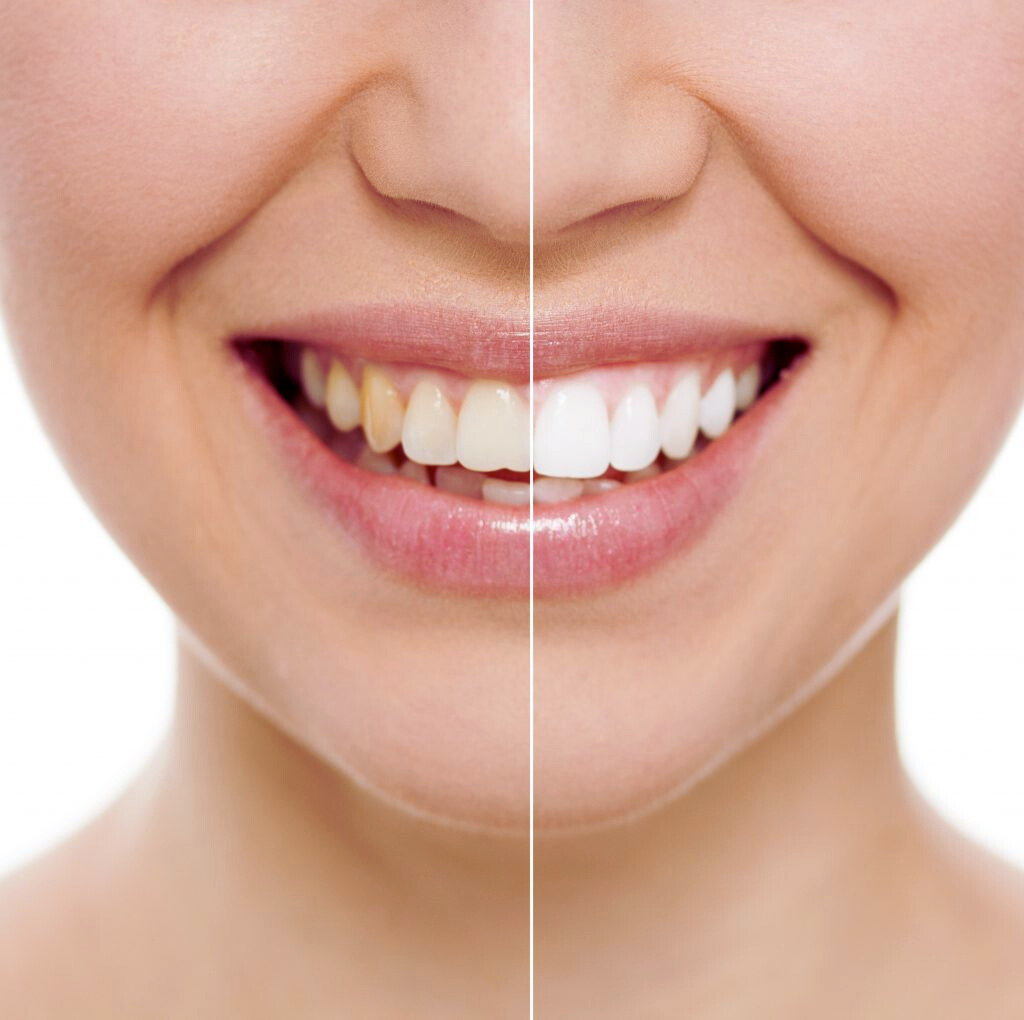 Cosmetic Dentistry