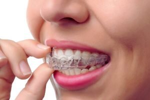 Will Invisible Braces Trigger Pain In Teeth?