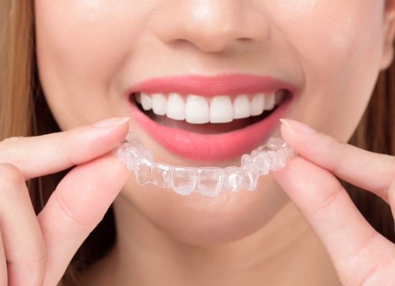 Invisalign in chandigarh