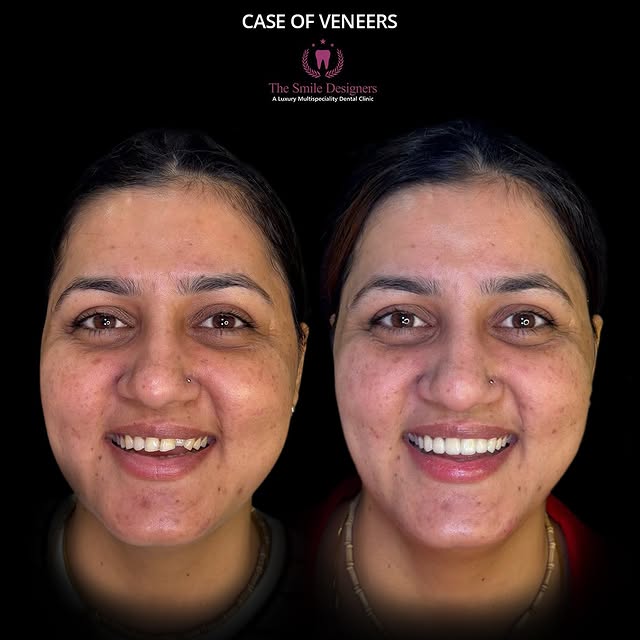 best dentist in chandigarh
