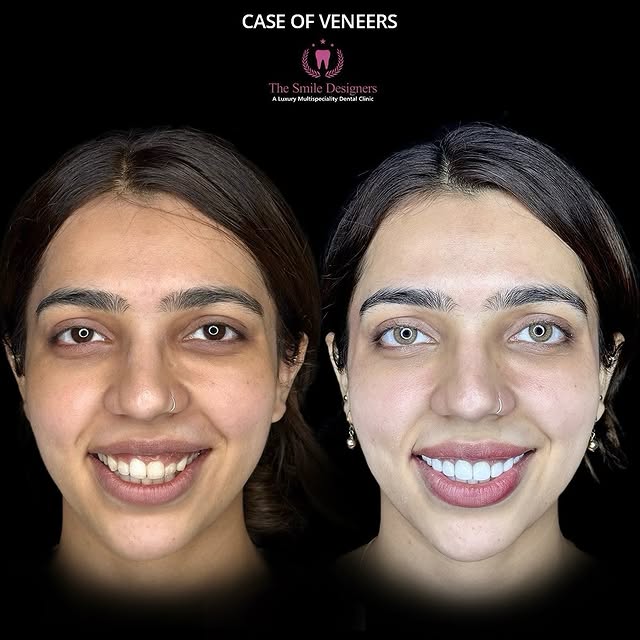 best dentist in chandigarh