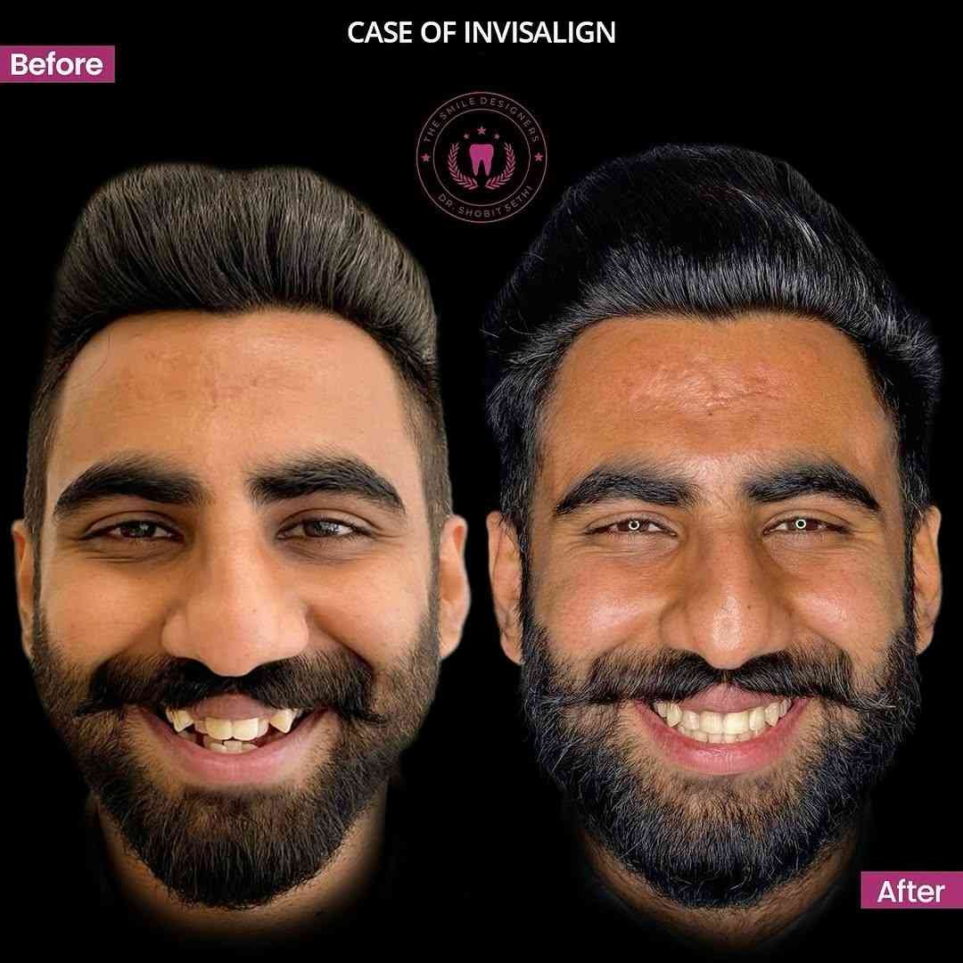 11 (1)