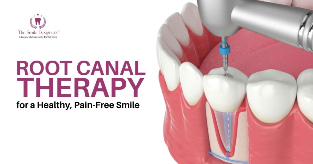 How to Find a Dentist in for Root Canal Treatment?