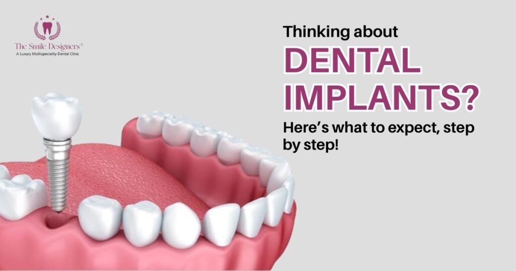 Best dentist in Chandigarh