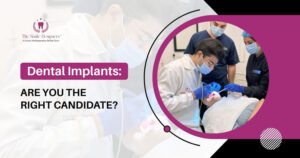 Are You a Candidate for Dental Implants?