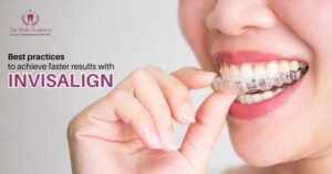 Tips for Faster Results With Invisalign Treatment in Mohali