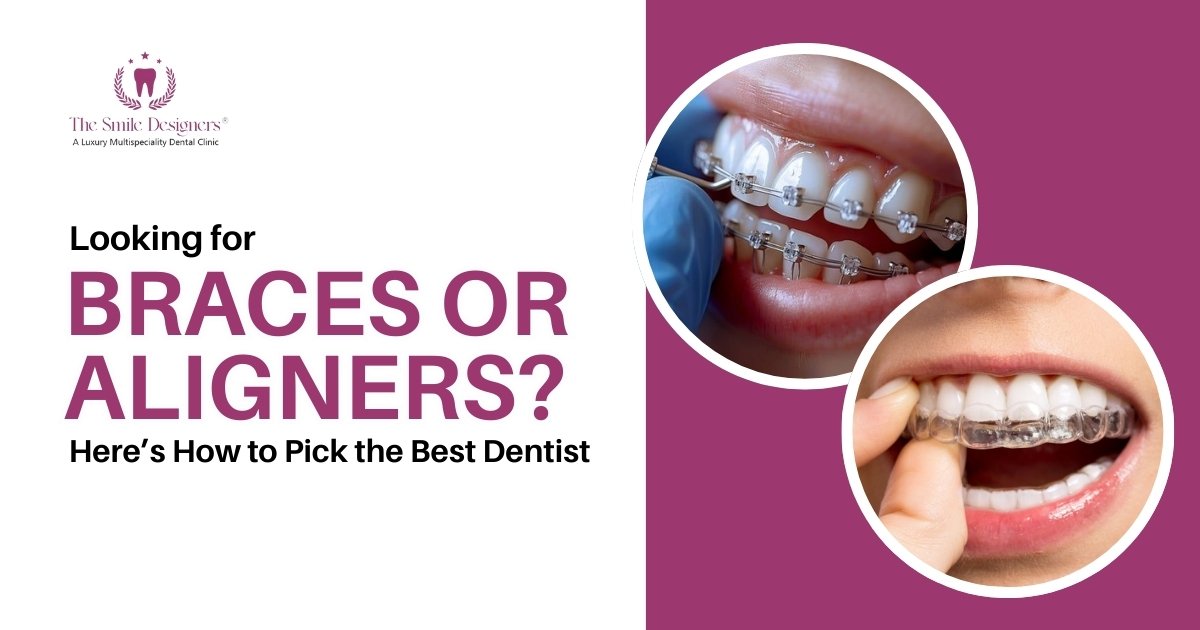 Best Dentist In Chandigarh