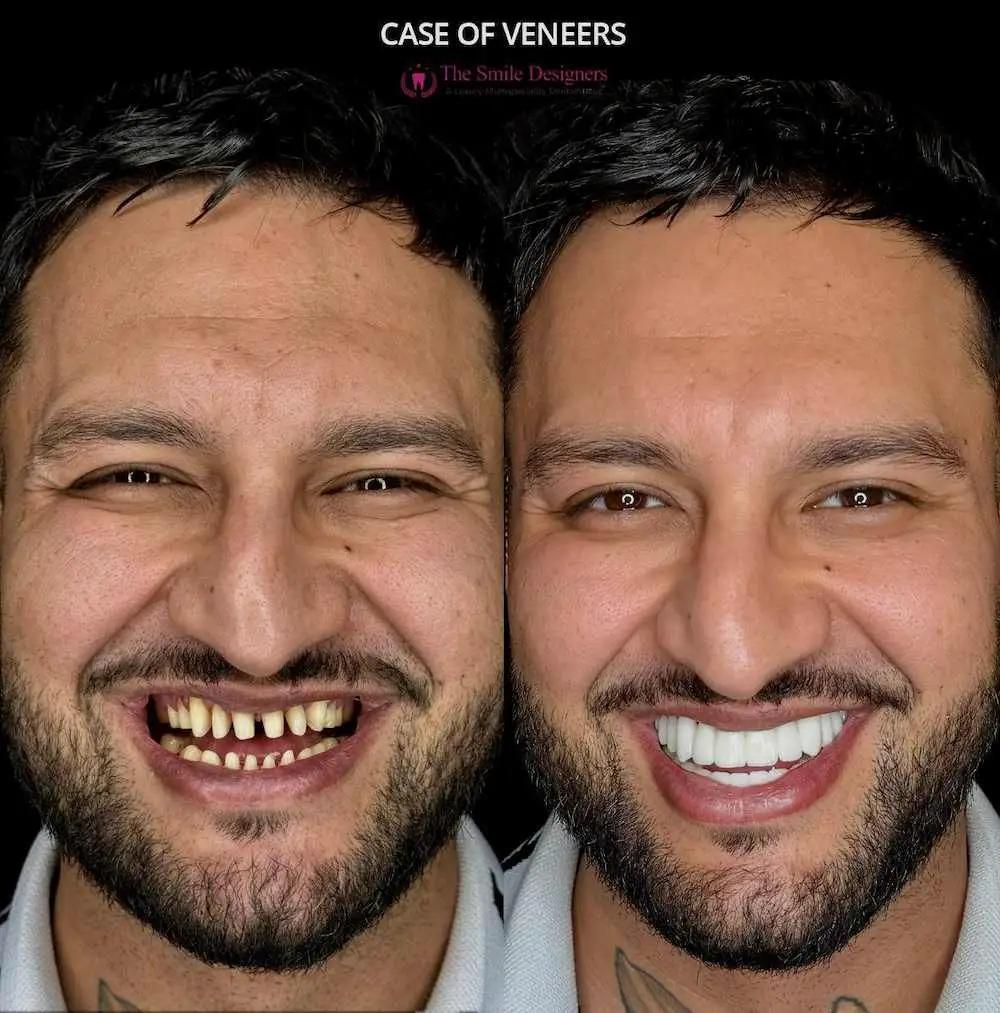 Best Dentist in Chandigarh Mohali - The Smile Designers