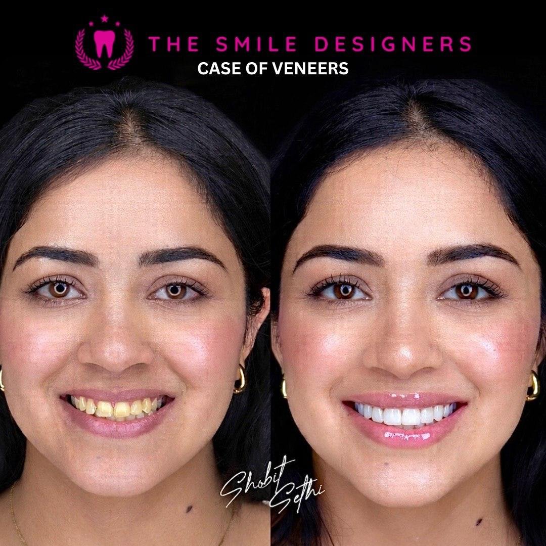before-after-img-3
