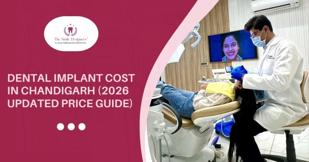 dental implants in Chandigarh