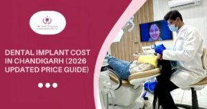 Dental Implant Cost in Chandigarh: 2026 Updated Price Guide