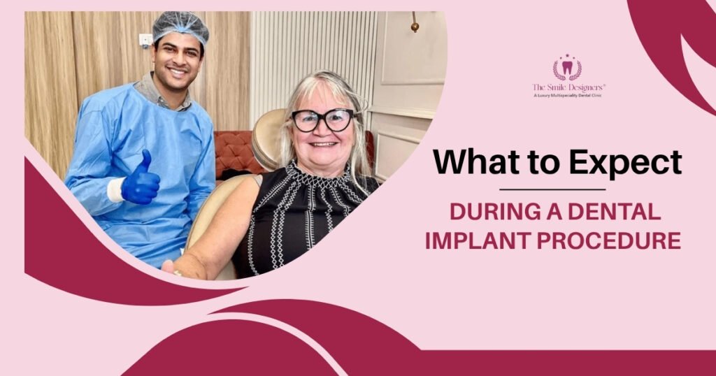 Dental implants in Mohali