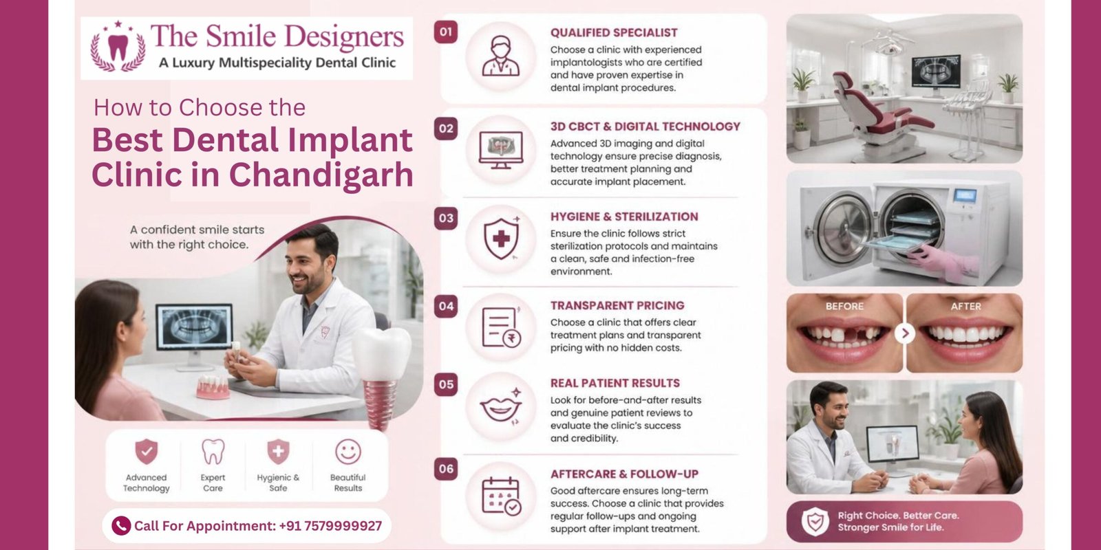 How to Choose the Best Dental Implant Clinic in Chandigarh