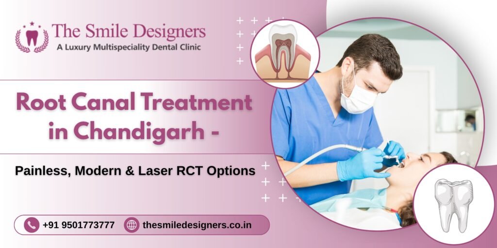 Root Canal Treatment in Chandigarh | The Smile Designers