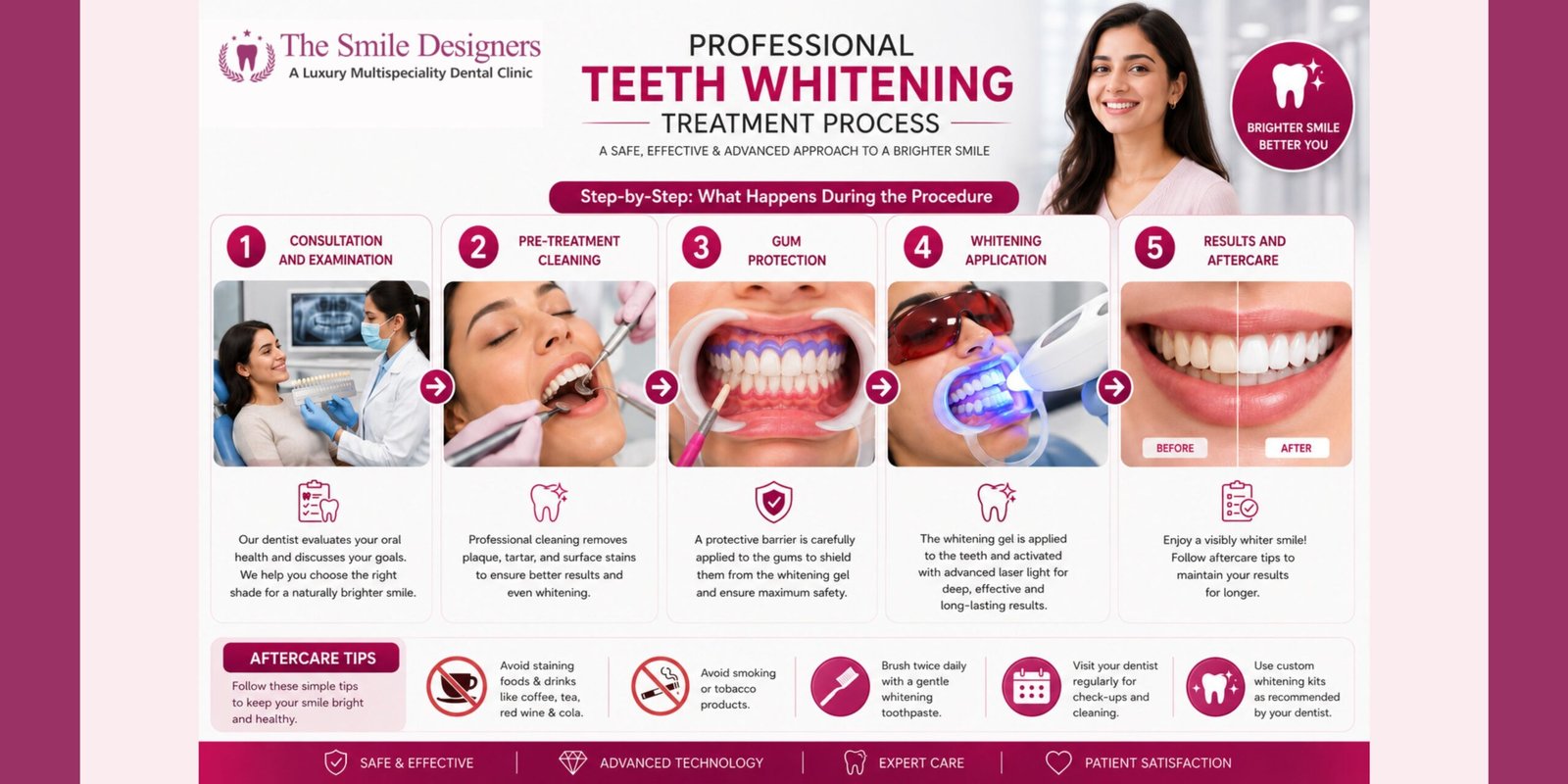 Step-by-Step Procedure