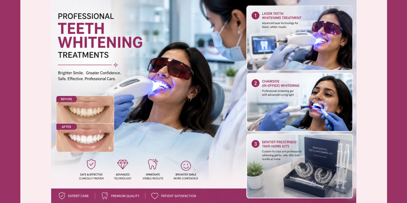 Types of Professional Teeth Whitening Treatments
