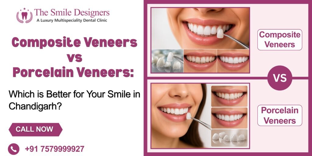 Composite Veneers vs Porcelain Veneers: Which is Better for Your Smile in Chandigarh?