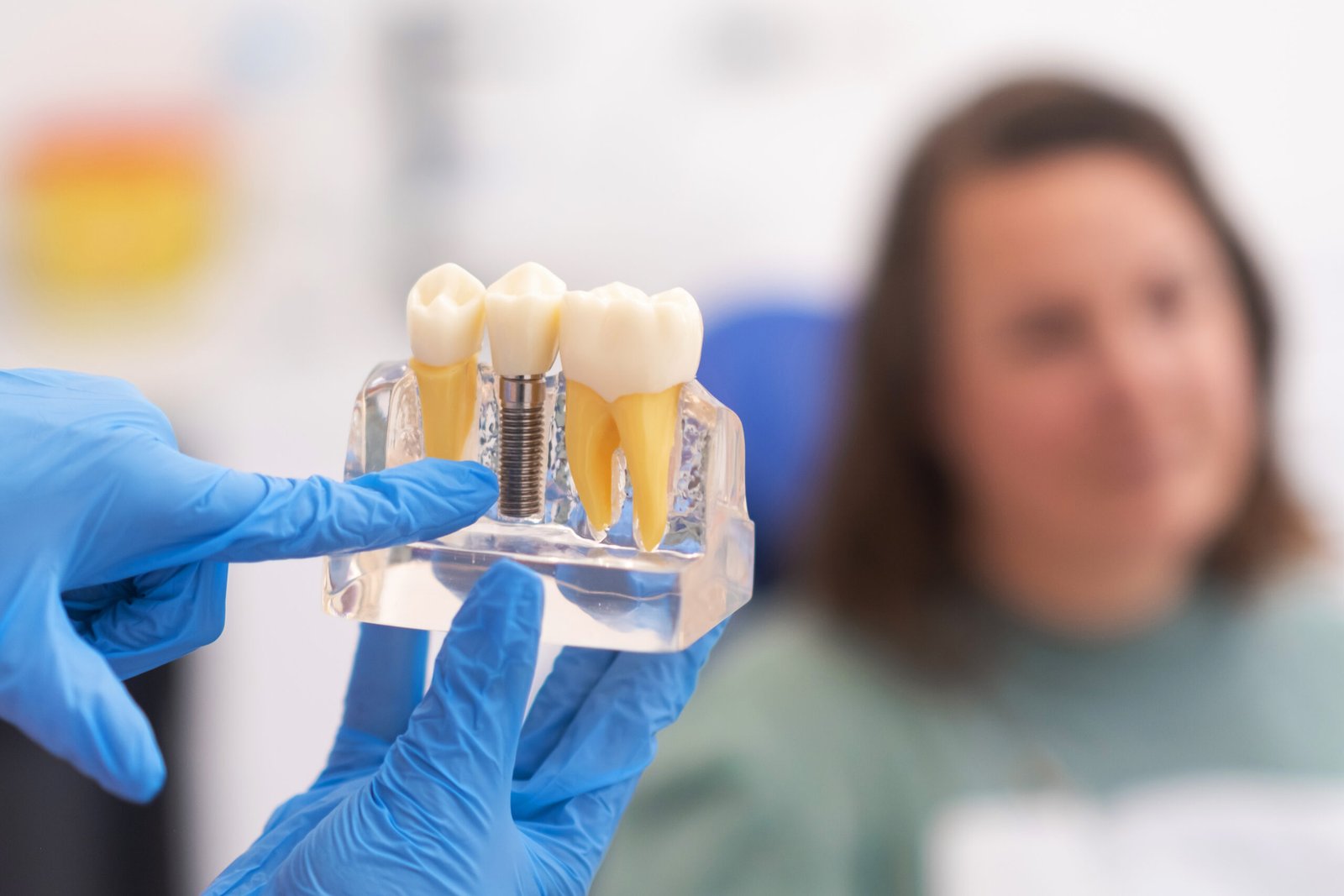 Dental implants at The Smile Designers
