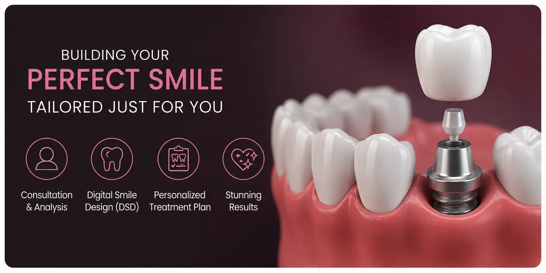 Building Perfect Hollywood Smile Tailored for Patient 