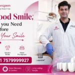 Hollywood Smile, Everything you Need to Know Before Changing Your Smile